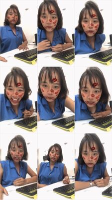 yuni artria 2024-06-05 25451